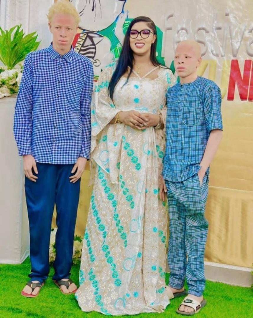 Journée internationale de sensibilisation à l’albinisme : La Présidente Fatoumata NIANE, marraine engagée pour l’inclusion. 